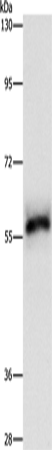 Western Blot analysis of Hela cell using HCK Polyclonal Antibody at dilution of 1:500