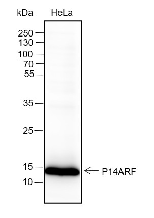 Recombinant CDKN2A/p14ARF Monoclonal Antibody-searchlist-1