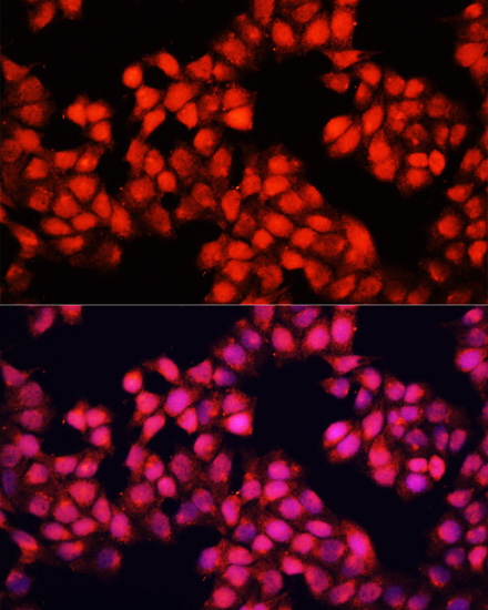 Immunofluorescence analysis of HeLa cells using ALAD Polyclonal Antibody at dilution of  1:100. Blue: DAPI for nuclear staining.