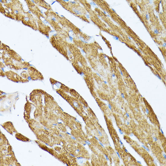 Immunohistochemistry of paraffin-embedded Mouse heart using TPM2 Polyclonal Antibody at dilution of 1:100 (40x lens).