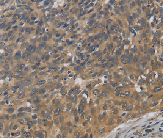 EMC8 Polyclonal Antibody - 3