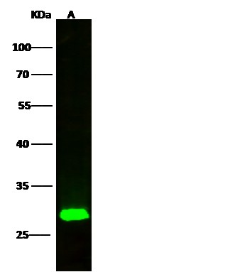 Recombinant ETHE1/HSCO Monoclonal Antibody - small - 2