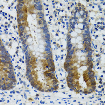 Immunohistochemistry of paraffin-embedded Human vermiform appendix using HSPH1 Polyclonal Antibody at dilution of 1:100 (40x lens).