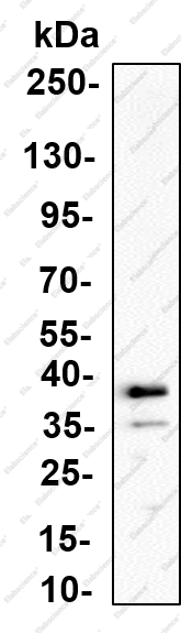 Recombinant SLC2A8 Monoclonal Antibody - 1