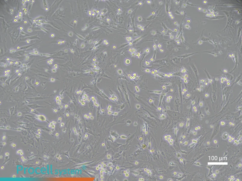 Mouse Vaginal Wall Fibroblast Complete Medium - 1