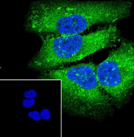Recombinant MYO1C Monoclonal Antibody - small - 3