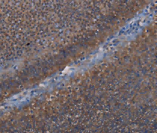 P3H3 Polyclonal Antibody - 2