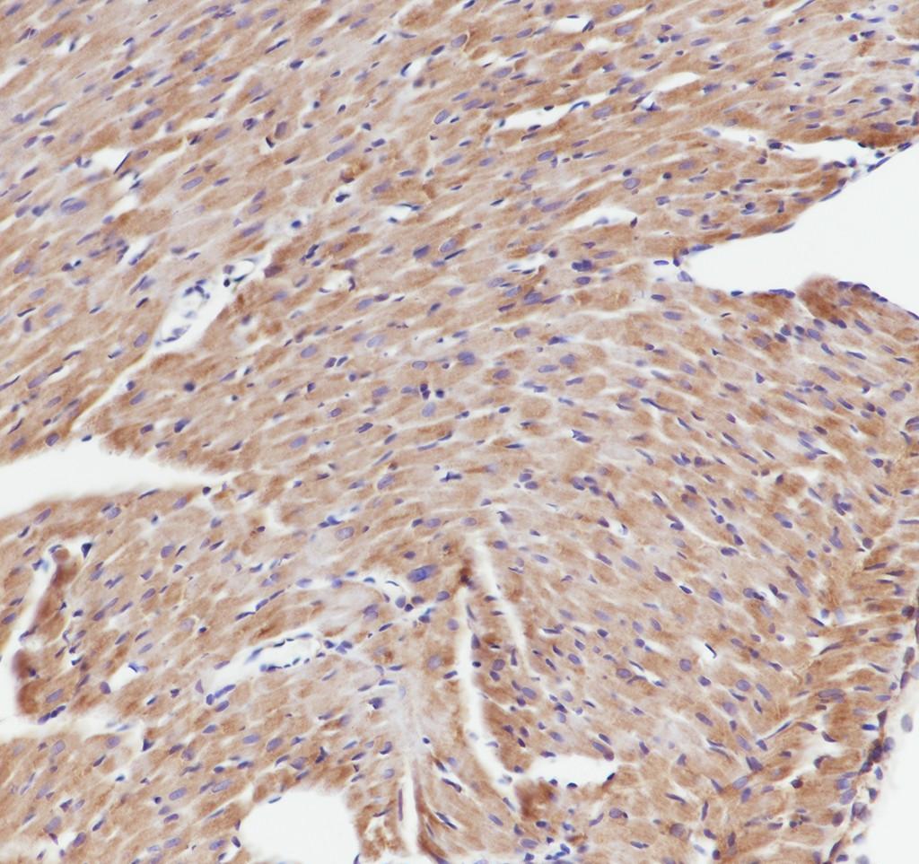 Recombinant eIF4A2 Monoclonal Antibody - small - 6