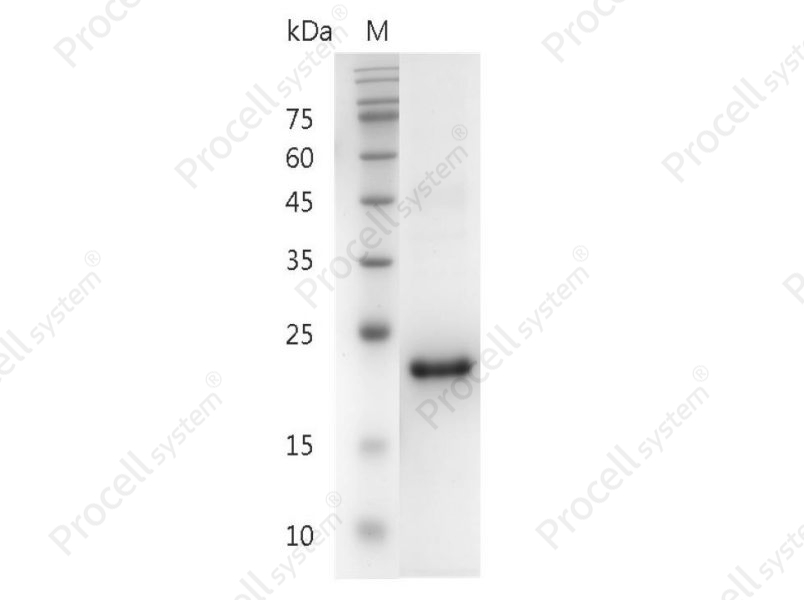 IL-29/IFN-&lambda;1, Human, Recombinant