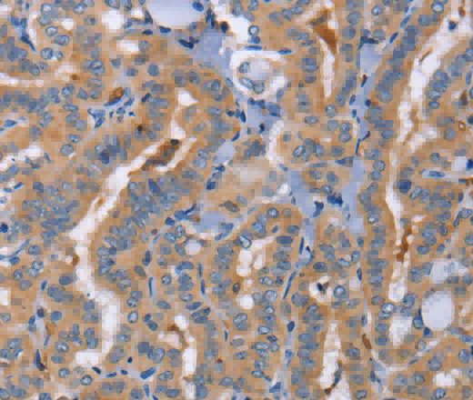 CD327 Polyclonal Antibody - 2