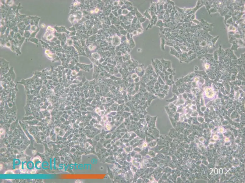 NCI-H520 Cell Complete Medium - small - 5