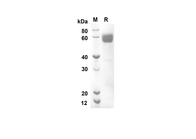 Recombinant Human LIF Protein(His Tag)-产品推荐-1
