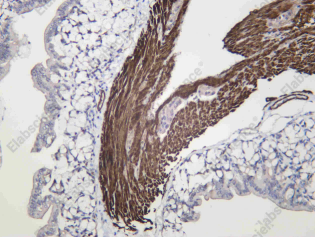 Recombinant Smoothelin Monoclonal Antibody - 2