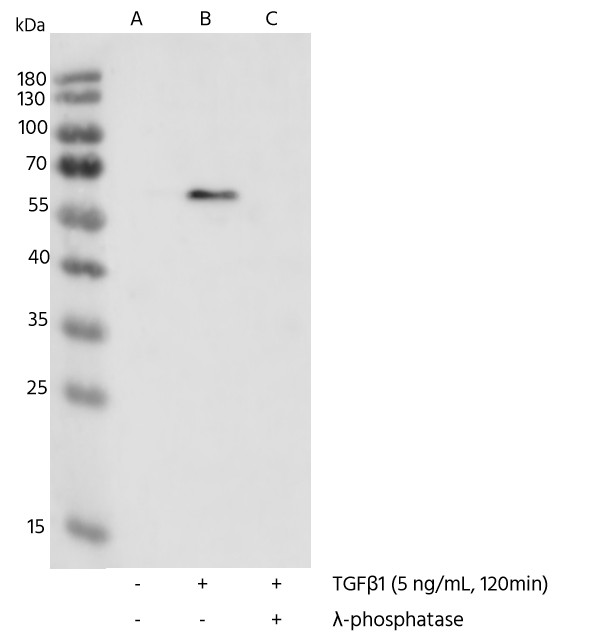 Recombinant Phospho-SMAD2 (Ser465, 467) Monoclonal Antibody - small - 3