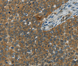 E2F6 Polyclonal Antibody - 2