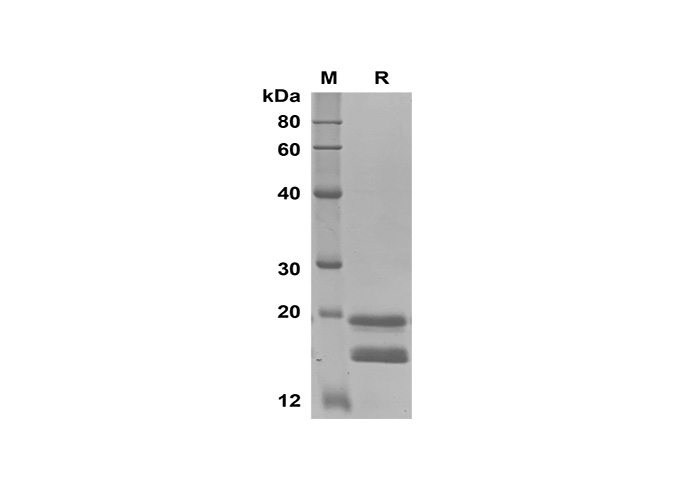 Recombinant Mouse CD4/LEU3 Protein(His Tag)-产品推荐-1