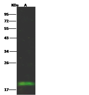 Recombinant Fragile histidine triad/FHIT Monoclonal Antibody - small - 2