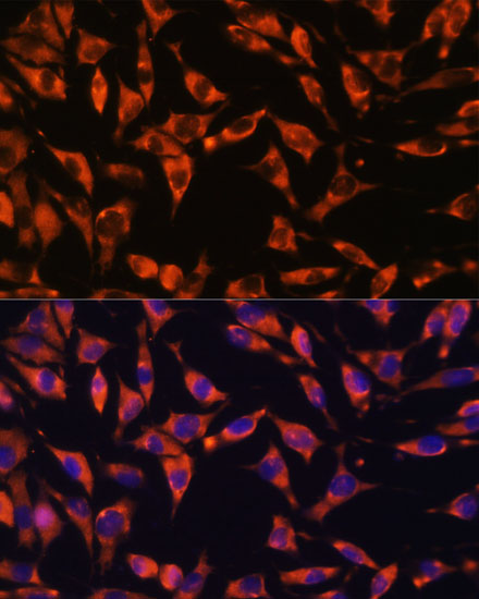 Immunofluorescence analysis of L929 cells using JAG2 Polyclonal Antibody at dilution of  1:100. Blue: DAPI for nuclear staining.