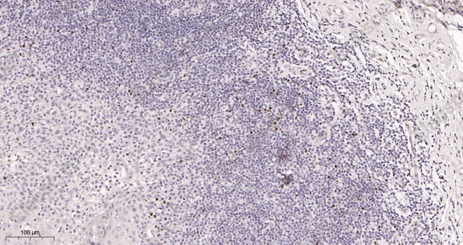Recombinant FOXP3 Monoclonal Antibody - 2