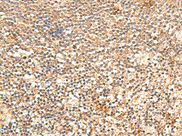 Immunohistochemistry of paraffin-embedded Human tonsil tissue  using TRAPPC1 Polyclonal Antibody at dilution of 1:60(?200)