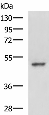 Western blot analysis of Hela cell lysate  using MYCN Polyclonal Antibody at dilution of 1:800