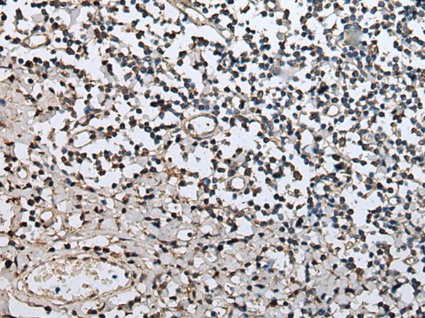 Immunohistochemistry of paraffin-embedded Human tonsil tissue  using ZFP36 Polyclonal Antibody at dilution of 1:40(?200)