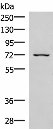 Western blot analysis of 293T cell lysate  using EIF2AK1 Polyclonal Antibody at dilution of 1:350