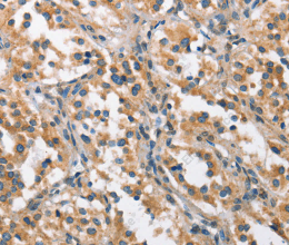 CHMP1A Polyclonal Antibody - 3