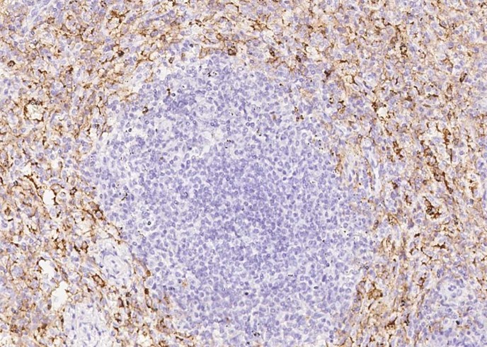CD16b/FCGR3B Monoclonal Antibody - small - 2