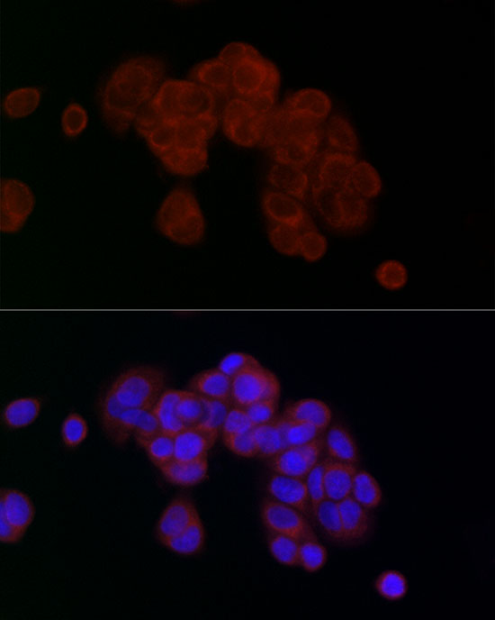 Immunofluorescence analysis of MCF7 cells using PGAM5 Polyclonal Antibody at dilution of 1:20 (40x lens). Blue: DAPI for nuclear staining.