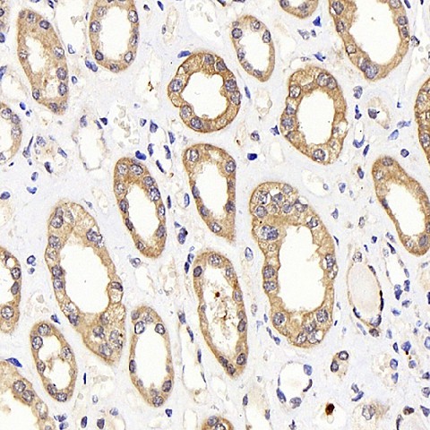 Immunohistochemistry analysis of parafffin-embedded human kideny  using LDHA Polyclonal Antibody at dilution of 1:1000.