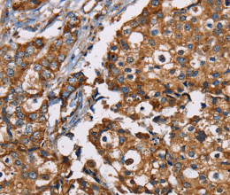 NDUFS1 Polyclonal Antibody - 3