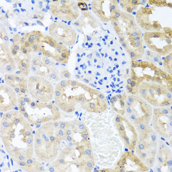 Immunohistochemistry of paraffin-embedded Rat kidney using MYLK Polyclonal Antibody at dilution of 1:100 (40x lens).