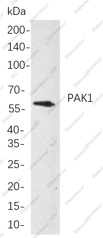 Recombinant PAK1 Monoclonal Antibody - 1