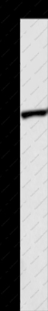 ABCB8 Polyclonal Antibody - 1