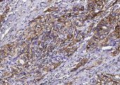 S100A10 Monoclonal Antibody - small - 3