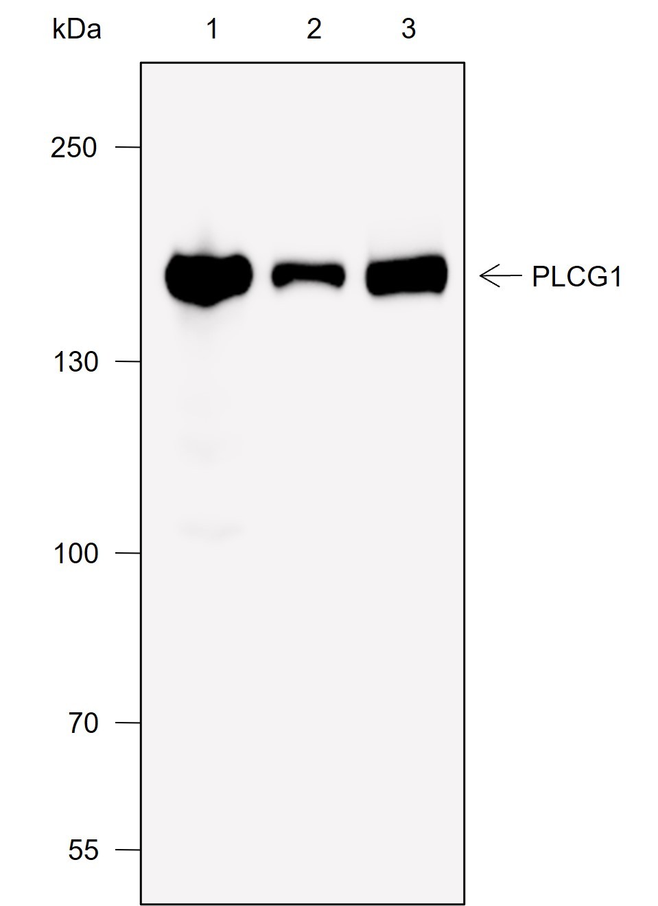 Recombinant PLCG1 Monoclonal Antibody-searchlist-1