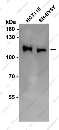 Recombinant PI3-Kinase p110 beta Monoclonal Antibody - 1