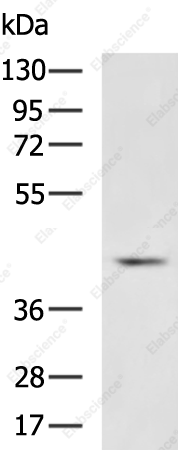 SERPINB5 Polyclonal Antibody - 2