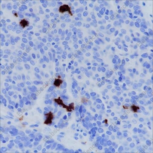 Recombinant CD1a Monoclonal Antibody - 3