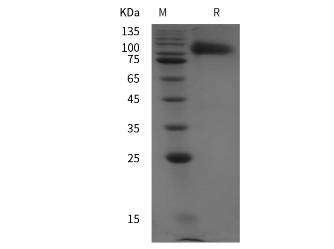 Recombinant Mouse IL-1 beta/IL1B Protein-产品推荐-4