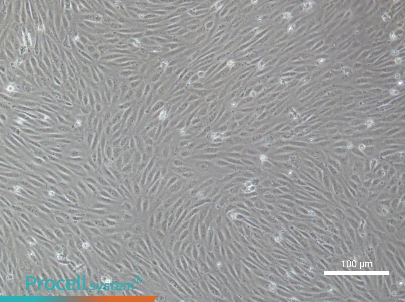 Human Choroidal Microvascular Endothelial Cell Complete Medium - 3