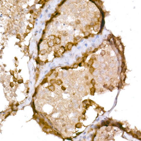 Immunohistochemistry of paraffin-embedded human testis using NY-ESO-1 Polyclonal Antibody at dilution of 1:150 (40x lens).Perform high pressure antigen retrieval with 10 mM Tris/EDTA buffer pH 8.0 before commencing with IHC staining protocol.