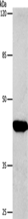 Western Blot analysis of Hela cell using CTGF Polyclonal Antibody at dilution of 1:850