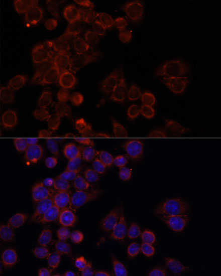 Immunofluorescence analysis of HeLa cells using mTOR Polyclonal Antibody at dilution of 1:100. Blue: DAPI for nuclear staining.