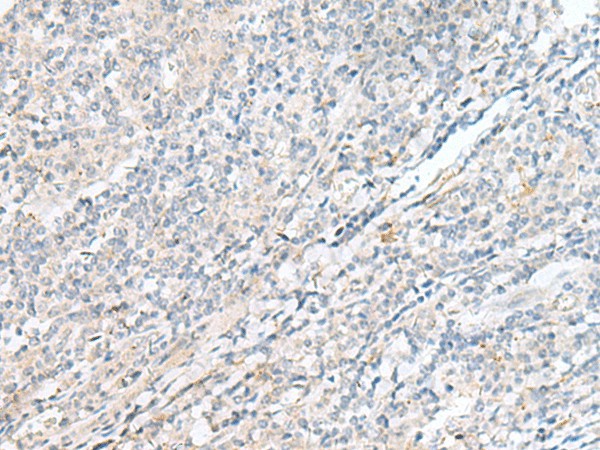 Immunohistochemistry of paraffin-embedded Human tonsil tissue  using POMGNT1 Polyclonal Antibody at dilution of 1:55(?200)