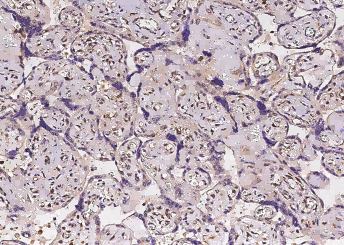 Tie1 Monoclonal Antibody - small - 2