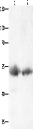 Western Blot analysis of Human lymphoma and liver cancer tissue  using JNK1 Polyclonal Antibody at dilution of 1:1000