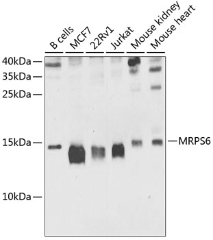 Western blot analysis of extracts of various cell lines using MRPS6 Polyclonal Antibody at 1:1000 dilution.