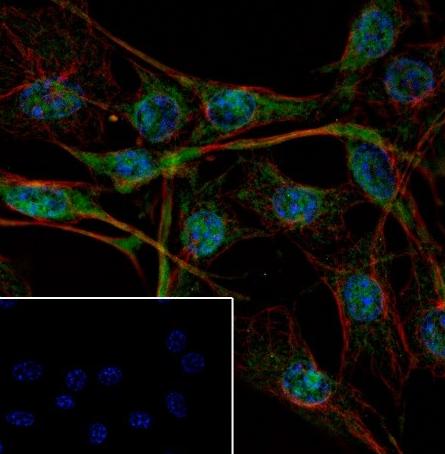 Recombinant RBX1 Monoclonal Antibody - small - 6